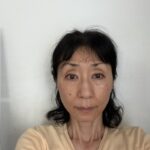 【リアル変化を追跡】日焼け・肝斑・シミでお悩みの61歳TO様のモニター体験がスタート！