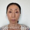 「20日目のお肌に変化？」モニター様のリアルな体験記