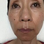 【美容液ムントジリモニターTO様体験記１】お肌のハリを実感した10日目のお肌比較