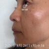 美容液ムントジリモニターTO様体験記③30日目:肌のやわらかさを実感
