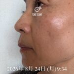 美容液ムントジリモニターTO様体験記③30日目:肌のやわらかさを実感