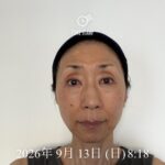美容液ムントジリモニターTO様体験記⑤50日目：毛穴が目立たなくなった！