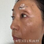 美容液ムントジリモニターTO様体験記④40日目：写メが前より若く写っている